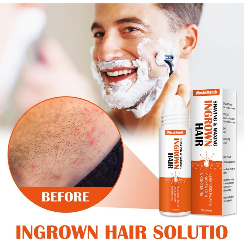 After Shave Ingrown Hair Solution - Reduce Redness