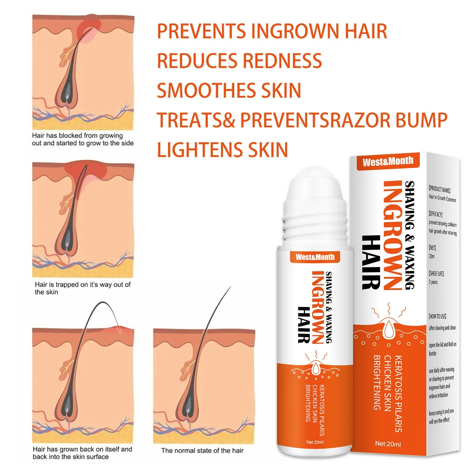 After Shave Ingrown Hair Solution - Reduce Redness