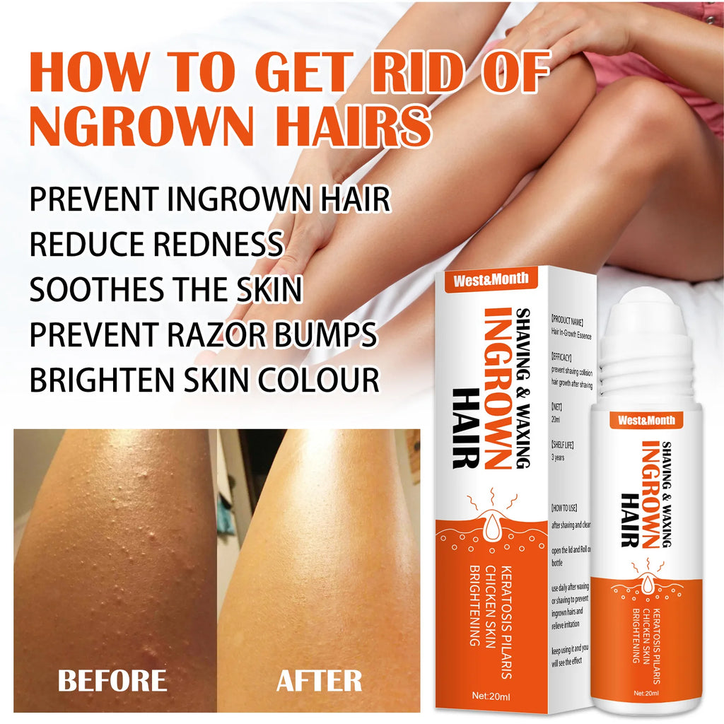 After Shave Ingrown Hair Solution - Reduce Redness